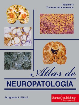 cover image of ATLAS DE NEUROPATOLOGÍA